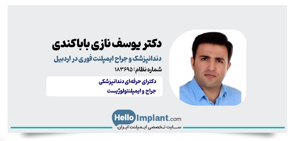 دکتر یوسف نازی باباکندی؛ کاشت ایمپلنت با دقت میلی‌متری