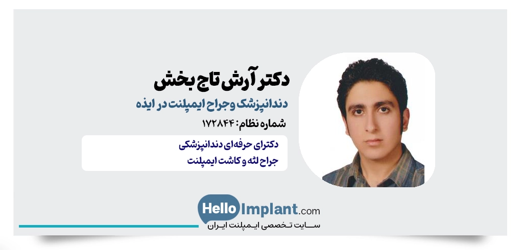 دکتر آرش تاجبخش از بهترین دکتر ایمپلنت در ایذه