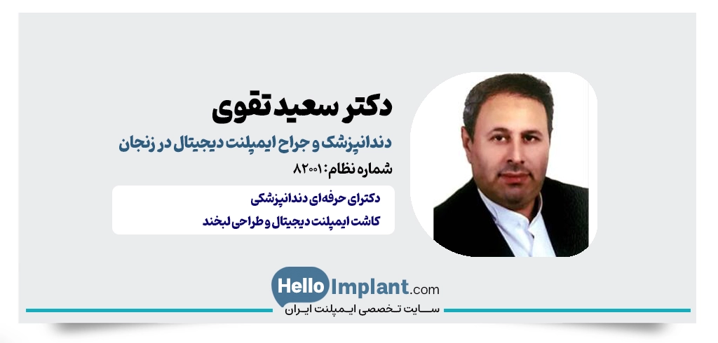 دکتر سعید تقوی؛ جراح و دندانپزشک ایمپلنت و زیبایی ایمپلنت دیجیتالی زنجان