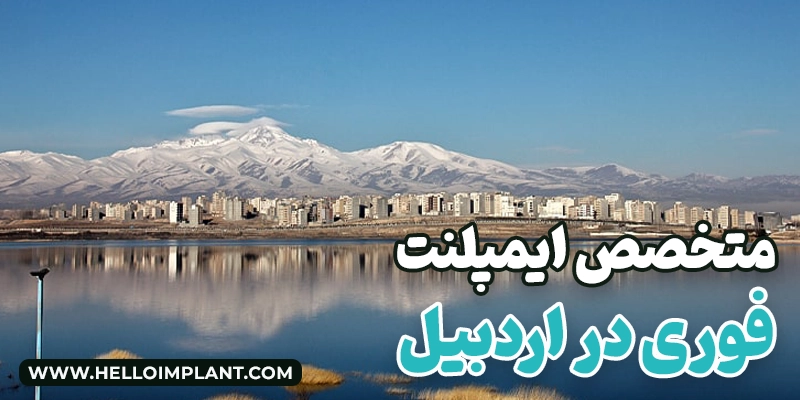 ایمپلنت فوری در اردبیل ایمپلنت فوری در اردبیل ایمپلنت فوری اردبیل ایمپلنت یک روزه در اردبیل