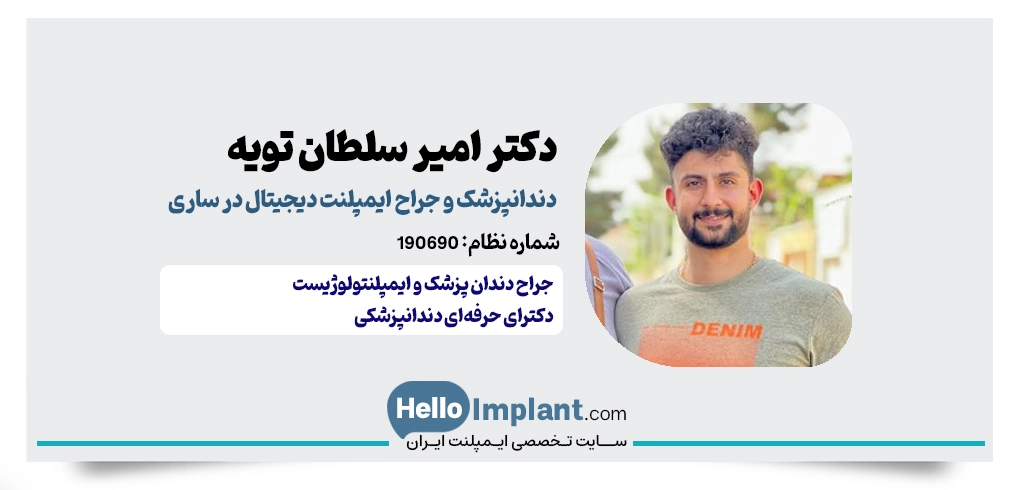 دکتر امیر سلطان تویه؛ مرکز تخصصی ایمپلنت دیجیتال در ساری دکتر ایمپلنت دیجیتال ساری دکتر ایمپلنت فوری در ساری دکتر ایمپلنت یکروزه در ساری