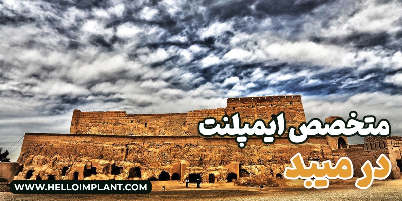 بهترین متخصصان ایمپلنت در میبد