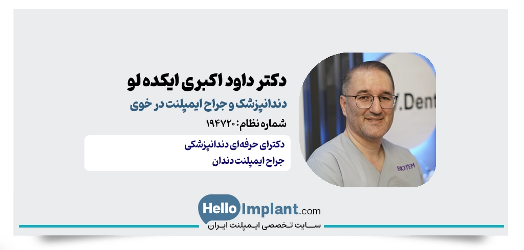 دکتر داود اکبری ایکده ل؛ بهترین دکتر ایمپلنت در خوی