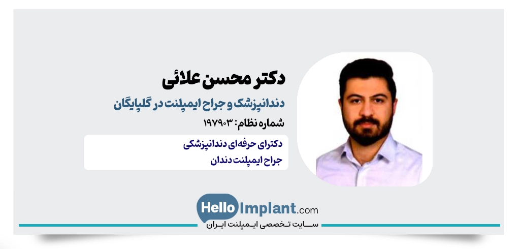 دکتر محسن علائی؛ دندانپزشک زیبایی در گلپایگان و کاشت ایمپلنت دندان