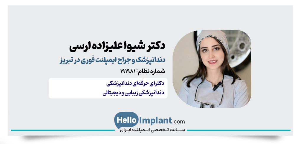 دکتر شیوا علیزاده؛ پرداخت اقساطی ایمپلنت یک‌روزه تبریز