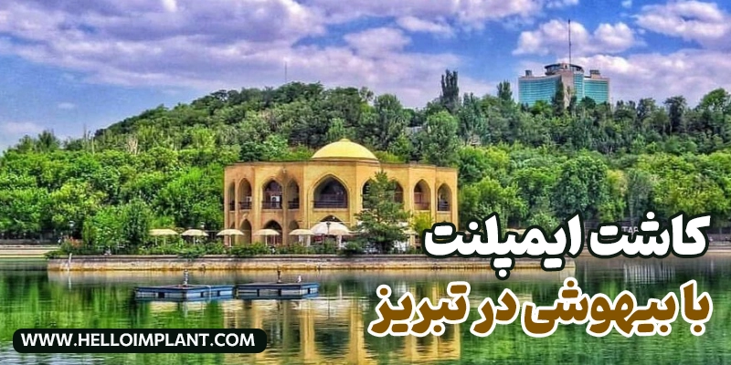 ایمپلنت با بیهوشی در تبریز؛ کاشت دندان با سدیشن تبریز دندانپزشکی با بیهوشی در تبریز
