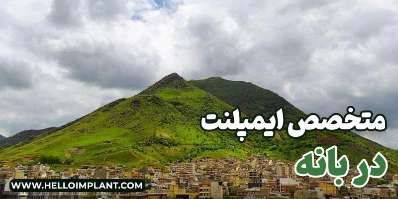 معرفی بهترین متخصص ایمپلنت در بانه