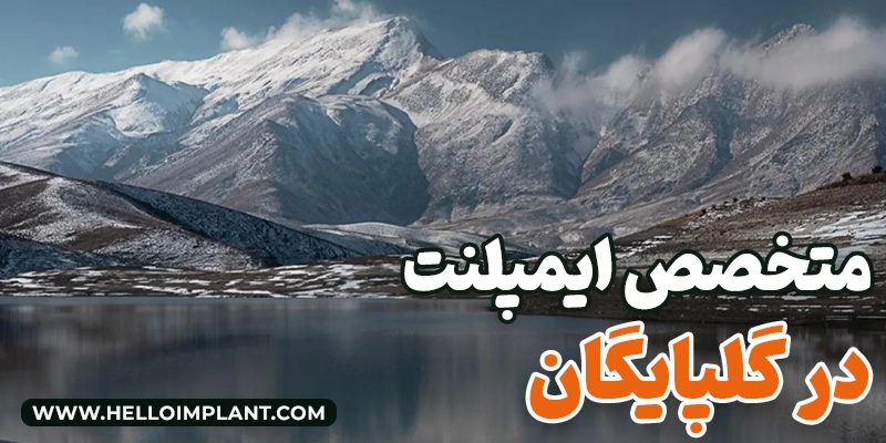 بهترین متخصص کاشت ایمپلنت در گلپایگان جراح و دندانپزشک گلپایگان