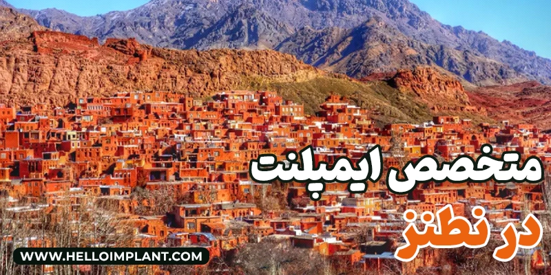 بهترین متخصص کاشت ایمپلنت در نطنز لیست بهترین دندانپزشکان ایمپلنت در نطنز