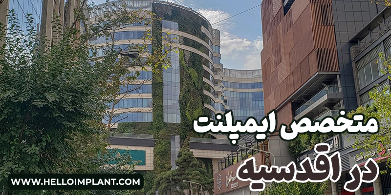 بهترین دکتر ایمپلنت در اقدسیه