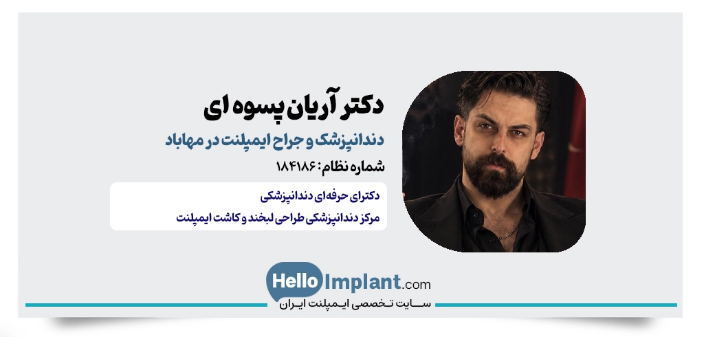دکتر آریان پسوهای جراح کاشت ایمپلنت دیجیتال در مهاباد