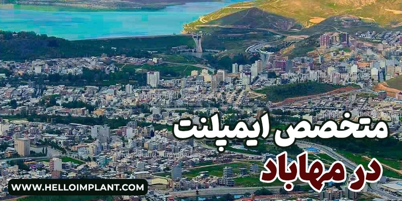 ایمپلنت دندان در مهاباد؛ معرفی پزشکان برتر و مراکز کاشت دندان