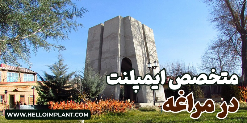 بهترین دکتر ایمپلنت در مراغه؛ معرفی ۵ کلینیک برتر و جراح کاشت دندان