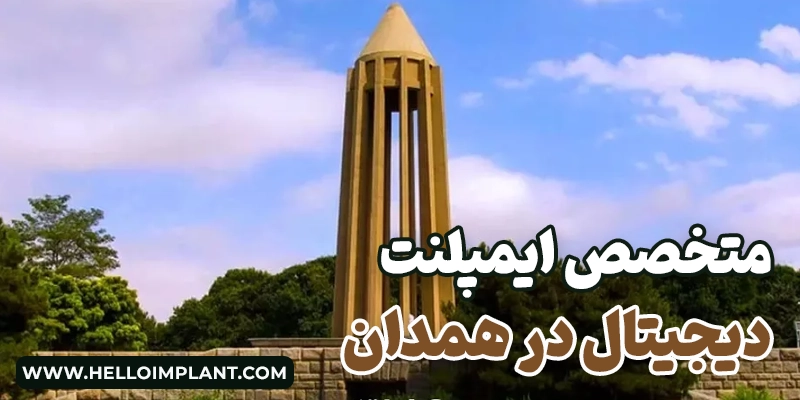 ایمپلنت دیجیتال در همدان | کاشت ایمپلنت فوری همدان