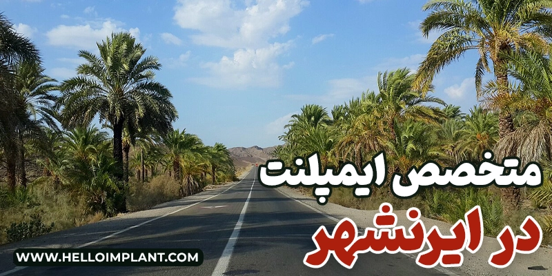 ایمپلنت دندان در ایرانشهر؛ معرفی دندانپزشکان و مراکز ارائه‌دهنده خدمات