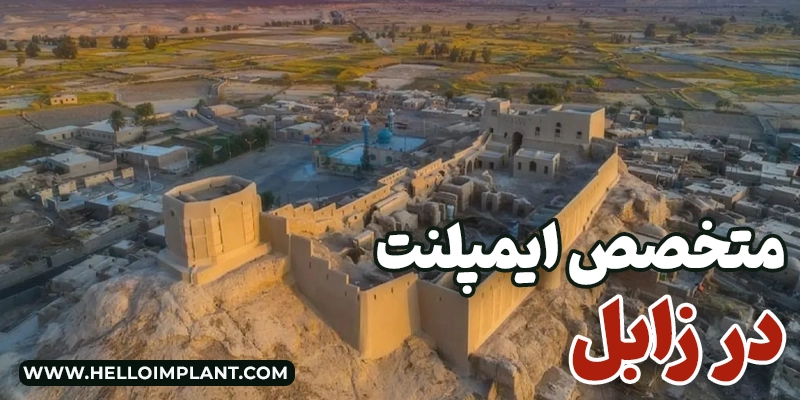 ایمپلنت دندان در زابل؛ معرفی دندانپزشکان و خدمات ایمپلنت